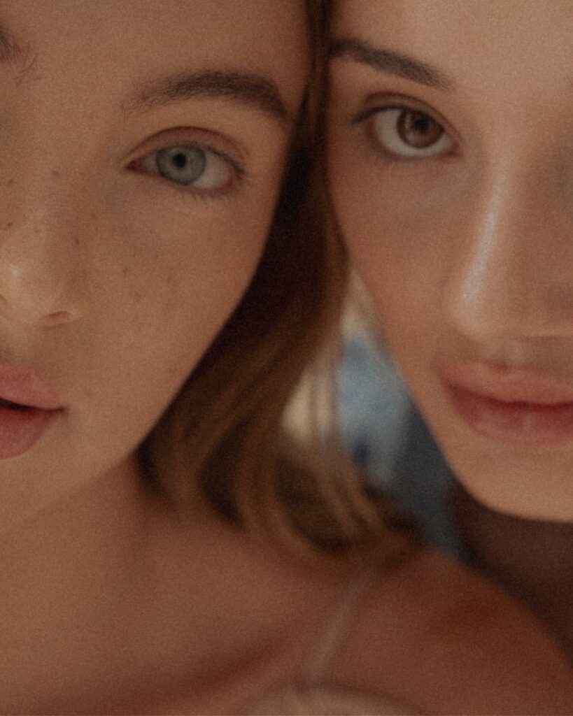 3 photo Miolift Tretman