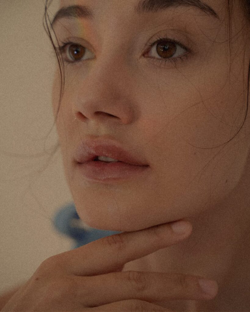 4 photo Miolift Tretman