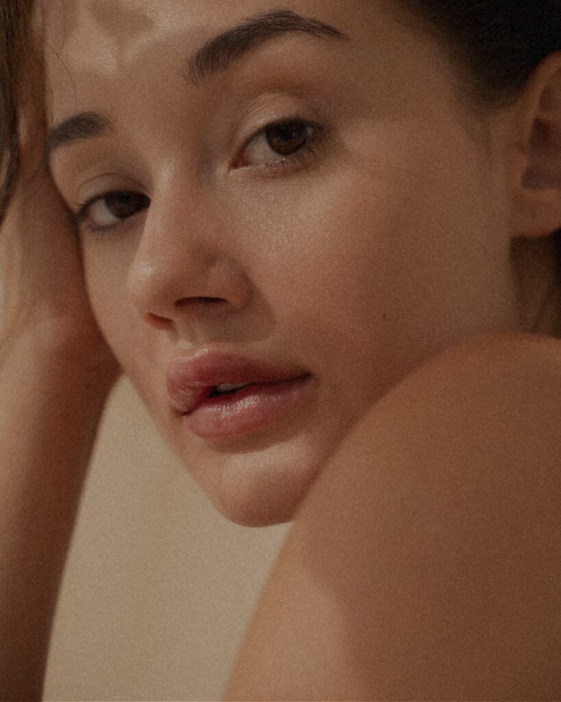 5 Photo Miolift Tretman