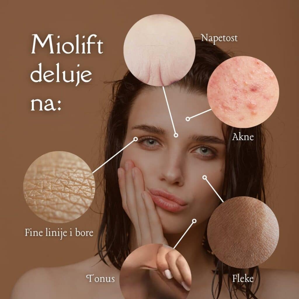Miolift tretman deluje trenutno