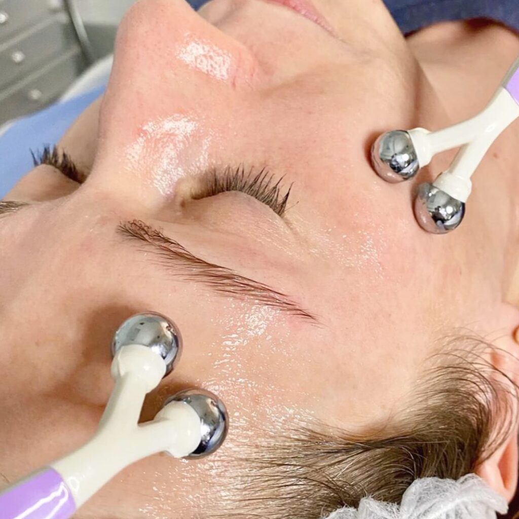 Miolift tretman lica mikrostrujama