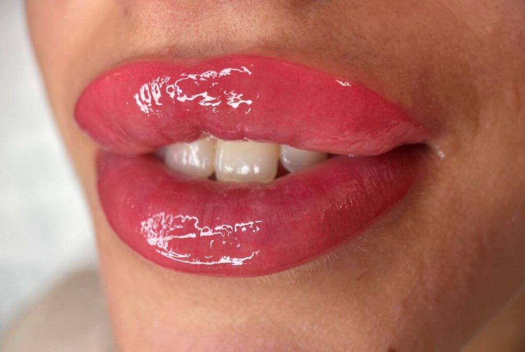 Savremeni beauty tretmani koji donose prirodan izgled