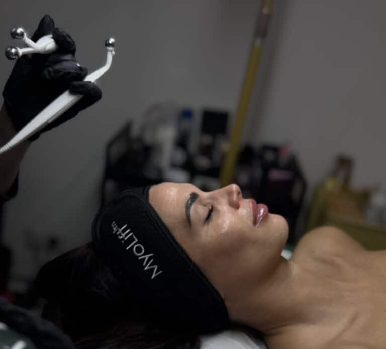 Miolift tretmani na Dorćolu